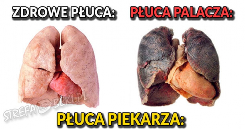 Zdrowe płuca vs płuca piekarza
